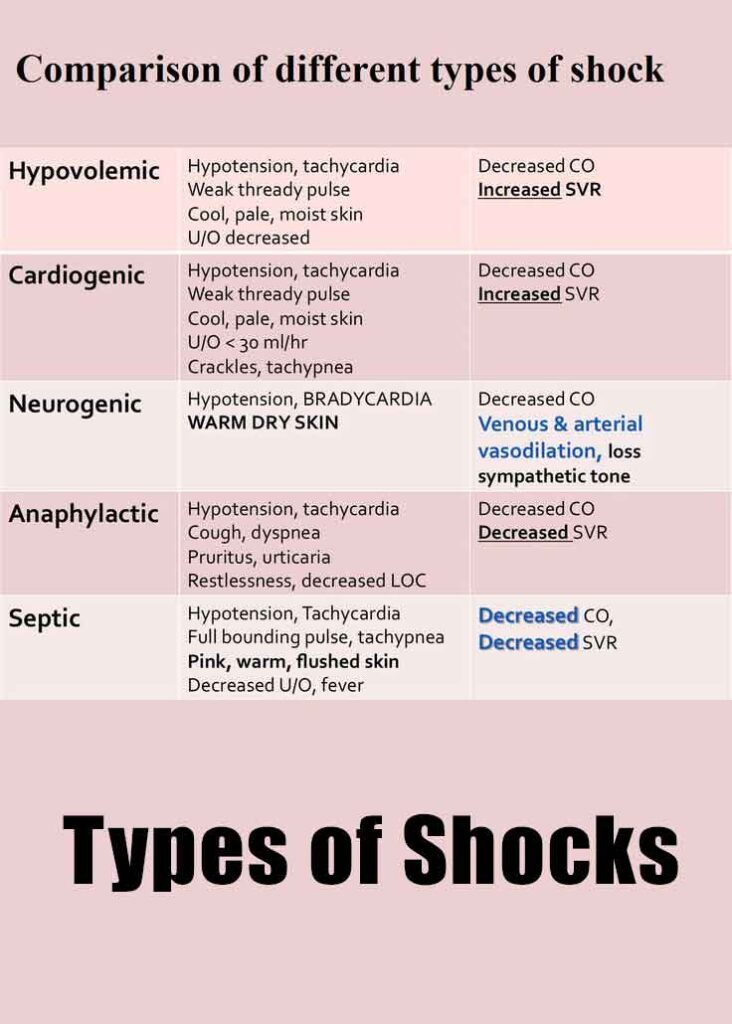 Types of Shocks for Silverado